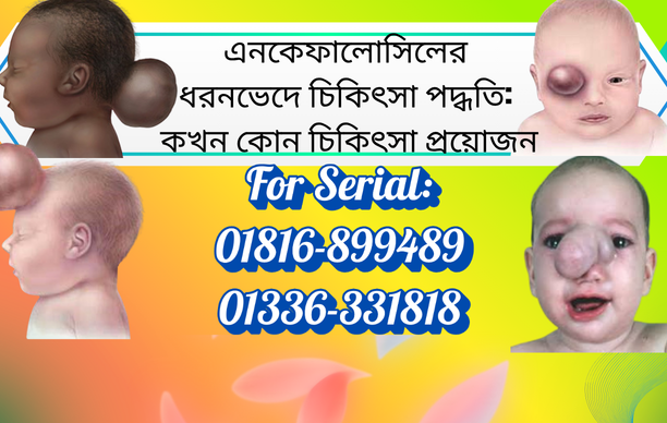 বাংলাদেশে শিশুদের এনকেফালোসিলের ধরনভেদে চিকিৎসা ও অপারেশন
